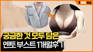 윈느성형외과 유튜브 영상 썸네일