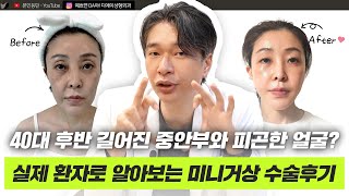 내 생애 가장 예뻤던 시절로? 미니거상을 통해 돌아가 보세요!ㅣ디에이성형외과