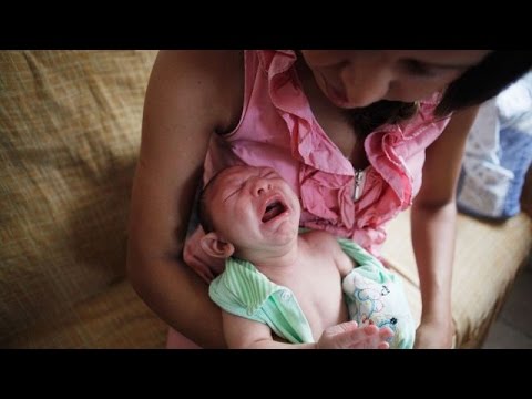 CDC Says the Zika Virus Does Cause Birth Defects - Newsy