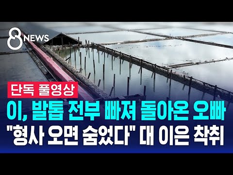 [단독] 이, 발톱 전부 빠져 돌아온 오빠…"형사 오면 숨었다" 대 이은 착취 (풀영상) / SBS 8뉴스
