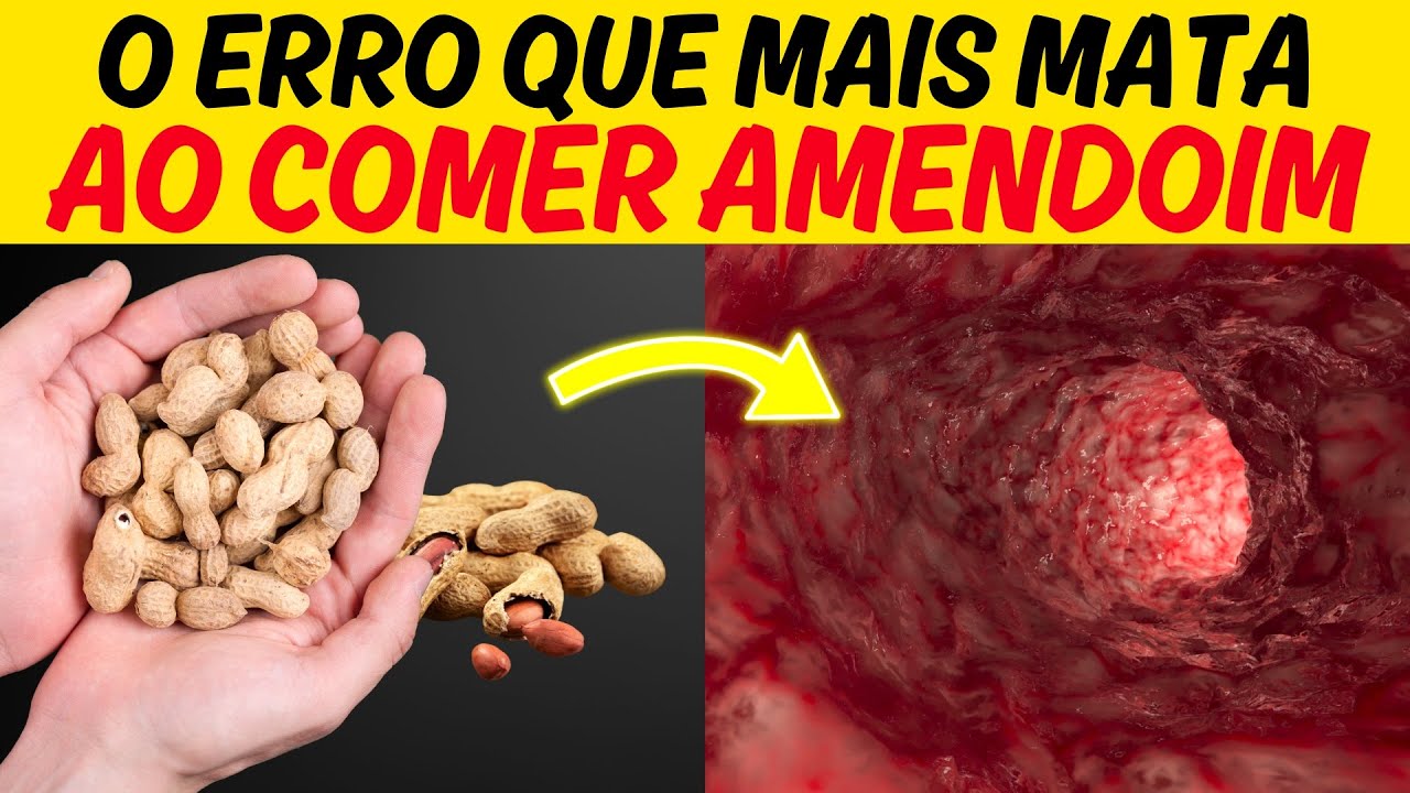 Coma Amendoim, mas Evite Estes Erros que Podem ser Fatal