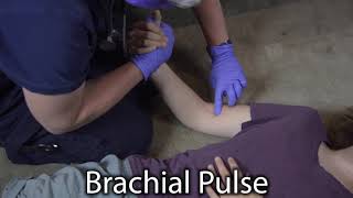 Brachial Pulse Palpation - Appropedia, the sustainability wiki