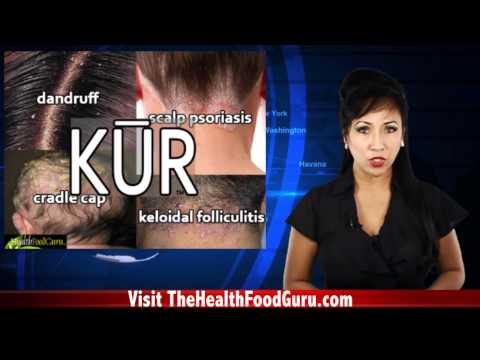 Dandruff After Shampooing