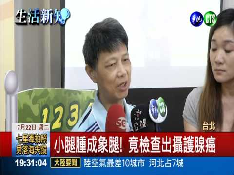 小腿腫成象腿! 竟檢查出攝護腺癌