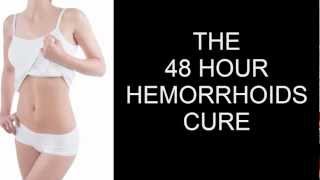 Treat External Hemorrhoids | The 48 Hour Cure | Cure External Hemorrhoids Fast without sugery