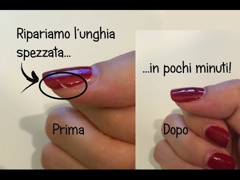 Prevenzione di sintomi di psoriasi Eczema varicoso unguenti fissi