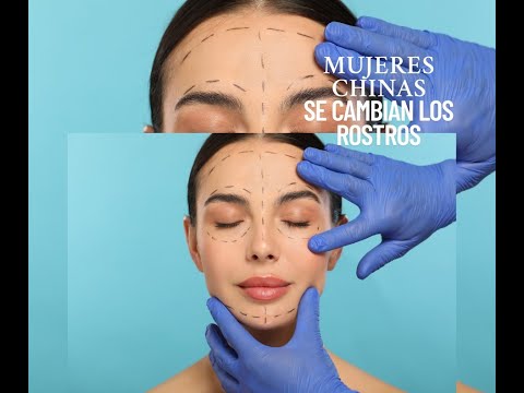 Es -MUJERES CHINAS SE TRANSPLANTAN ROSTROS DE NIÑOS - HIPNOSIS REGRESIVA DIAMANTE