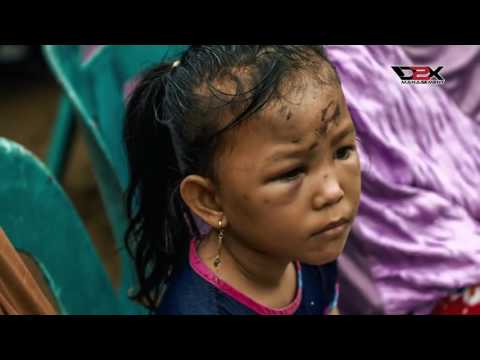 Lagu Aceh Joel Keudah - Kisah Seudeh Geumpa Pidie Jaya - Pray To Pidie Jaya