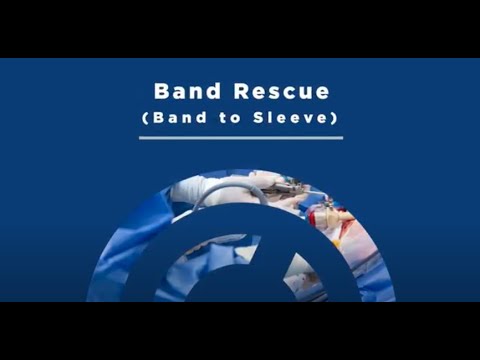 The Band To Sleeve Revision Surgery With Bariatric Surgeon Dr. Ariel Ortiz