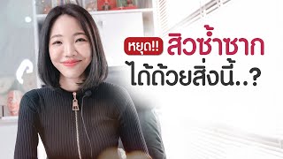 เคล็ดลับทายาสิวไม่ให้เกิดสิวซ้ำซาก | เคล็ดลับลดสิว EP.10 | Vikkaskincare เซรั่มลดสิว