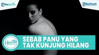 Penyebab Bercak Putih di Kulit yang Tak Kunjung Hilang, Ini Cara Mudah Atasi Panu akibat Jamur