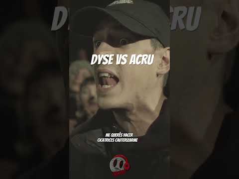 YOUR TEAM IS REALLY NERVOUS 🎬 #acru #dyse #freestyle #hiphop #rap