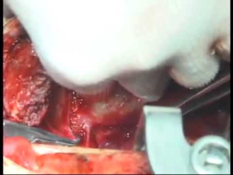 Autunno problemi articolari Bruciando lingua e osteocondrosi cervicale