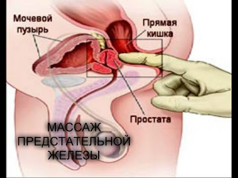 Виды простатита