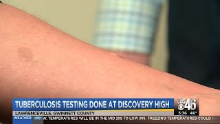 Tuberculosis testing done at Discovery Hgih School