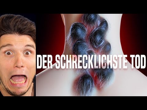 Paluten REAGIERT auf Was würde passieren, wenn dich die giftigste Kreatur der Welt beißt