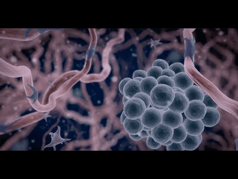 Stivarga - Customer Success Story