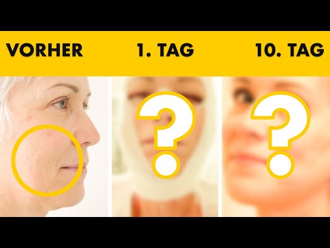 Facelift 4 in 1 OP mit 55 Jahren: JEDEN TAG ein Foto dokumentiert | Heilungsverlauf | Dr. Jungwirth