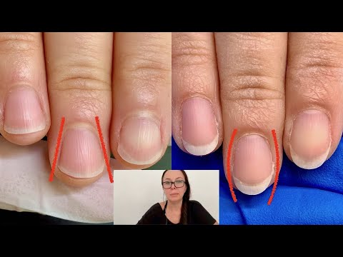 How I shaped these nails from fanning out to oval. [Nail technician explains]