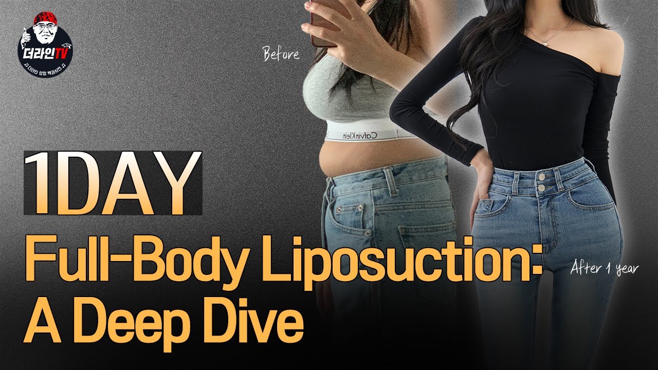 Full Body Liposuction - TheLINE Plastic Surgery video