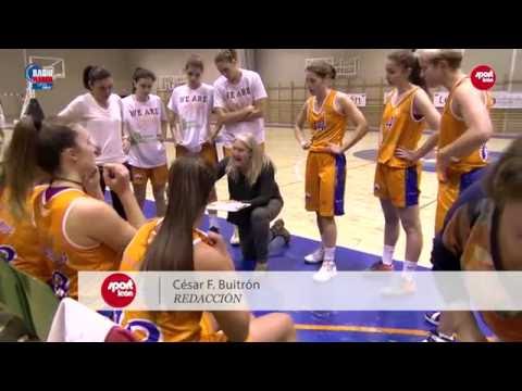 Aros Patatas Hijolusa 75 - Segle XXI 50