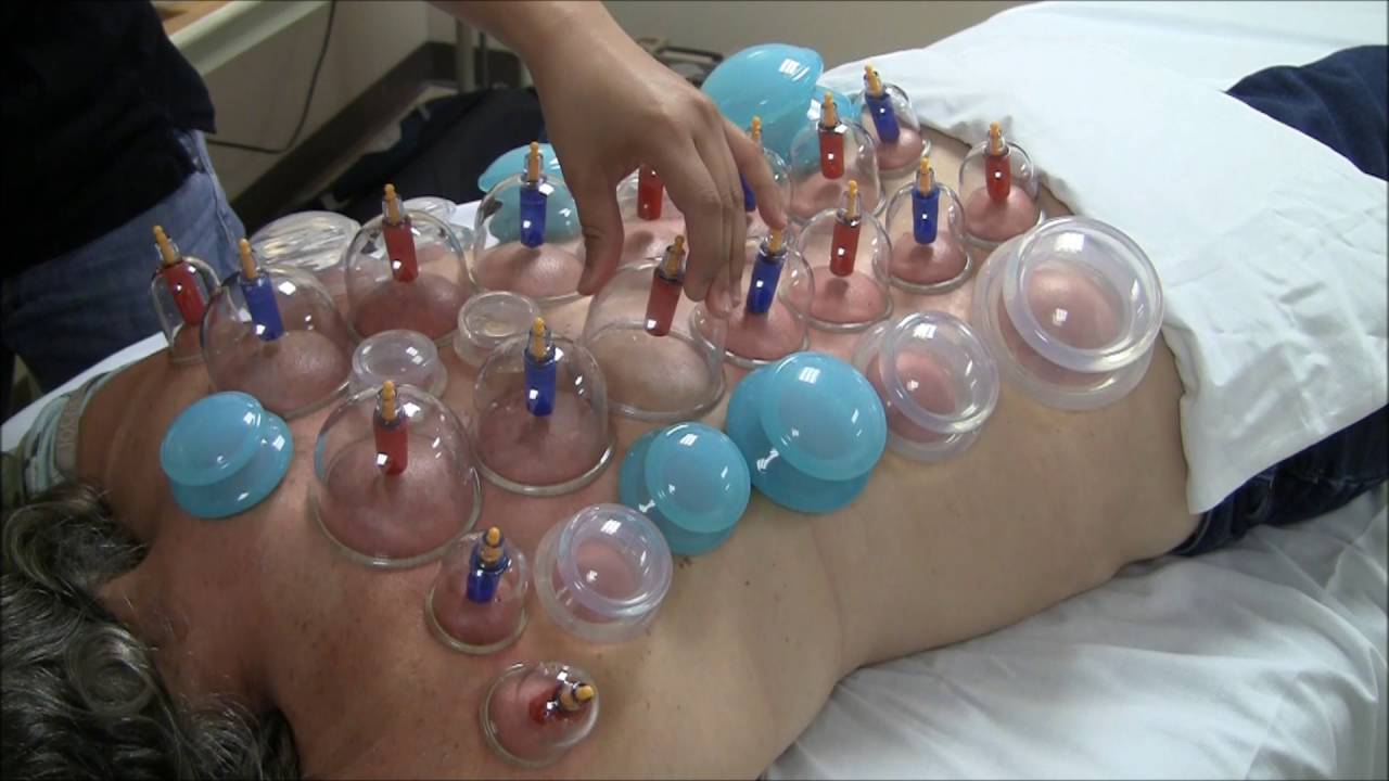 The Cupping Blanket - YouTube