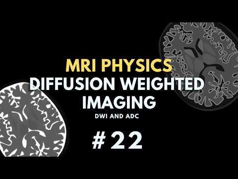 Diffusion Weighted Imaging (DWI) and Apparent Diffusion Coefficient (ADC) | MRI Physics Course #22