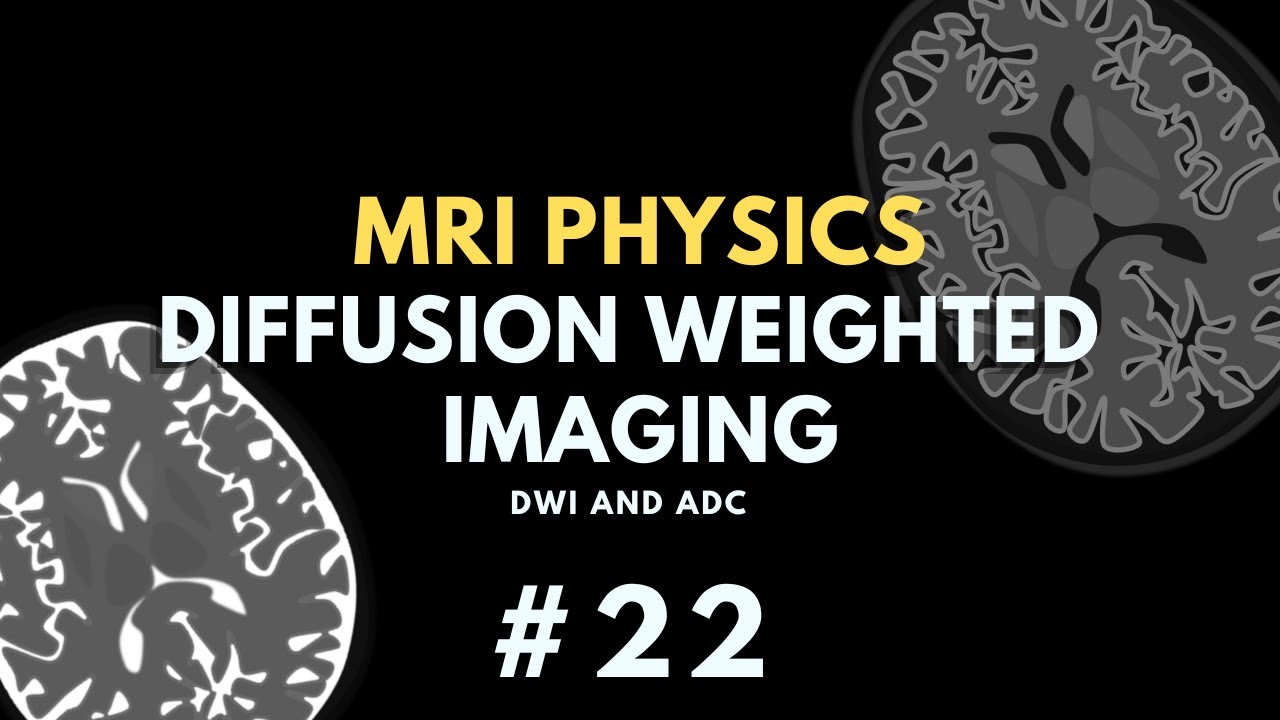 Diffusion Weighted Imaging (DWI) and Apparent Diffusion Coefficient (ADC) | MRI Physics Course #22