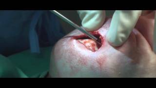 Dr. Philip Young