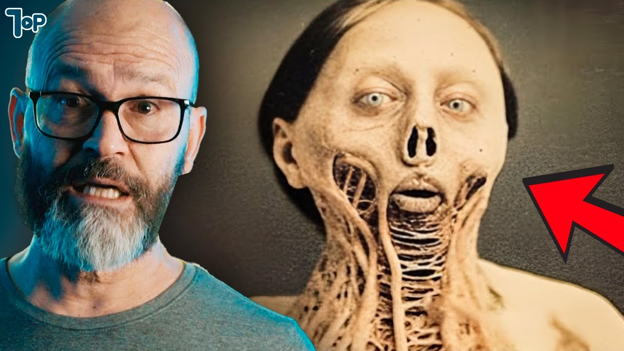 15 Doenças Mais Terríveis de Toda a História!