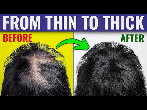 The Ultimate Guide to Thicker Hair - Dr. Berg's Expert...