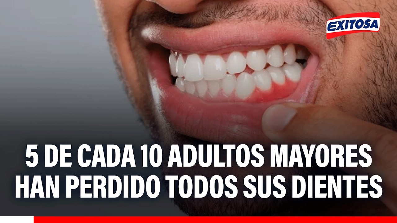 🔴🔵 5 de cada 10 adultos mayores han perdido todos sus dientes
