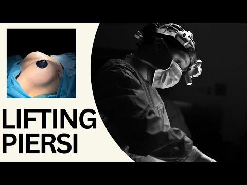 Piotr  Turkowski-54