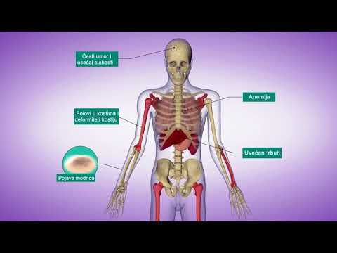 Gošeova bolest - Edukativni film