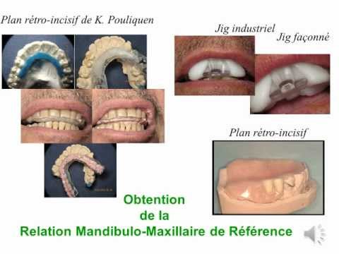 comment bien s'appliquer du fond de teint