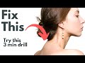Fix Neck Hump With 3 Minute Drill