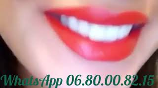 Snap on smile Oujda