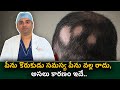 Alopecia Areata Symptoms Causes And Treatment Treatment For Alopecia Areata Hair Loss Treatment