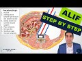 Anterior lumbar interbody fusion (ALIF) - Step by step procedure details, anatomy, & recovery review
