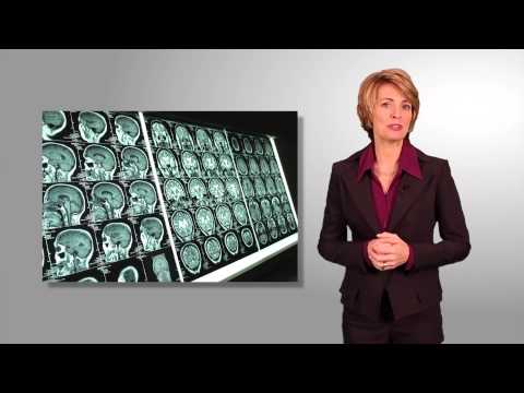 Are Migraines Damaging Your Brain?