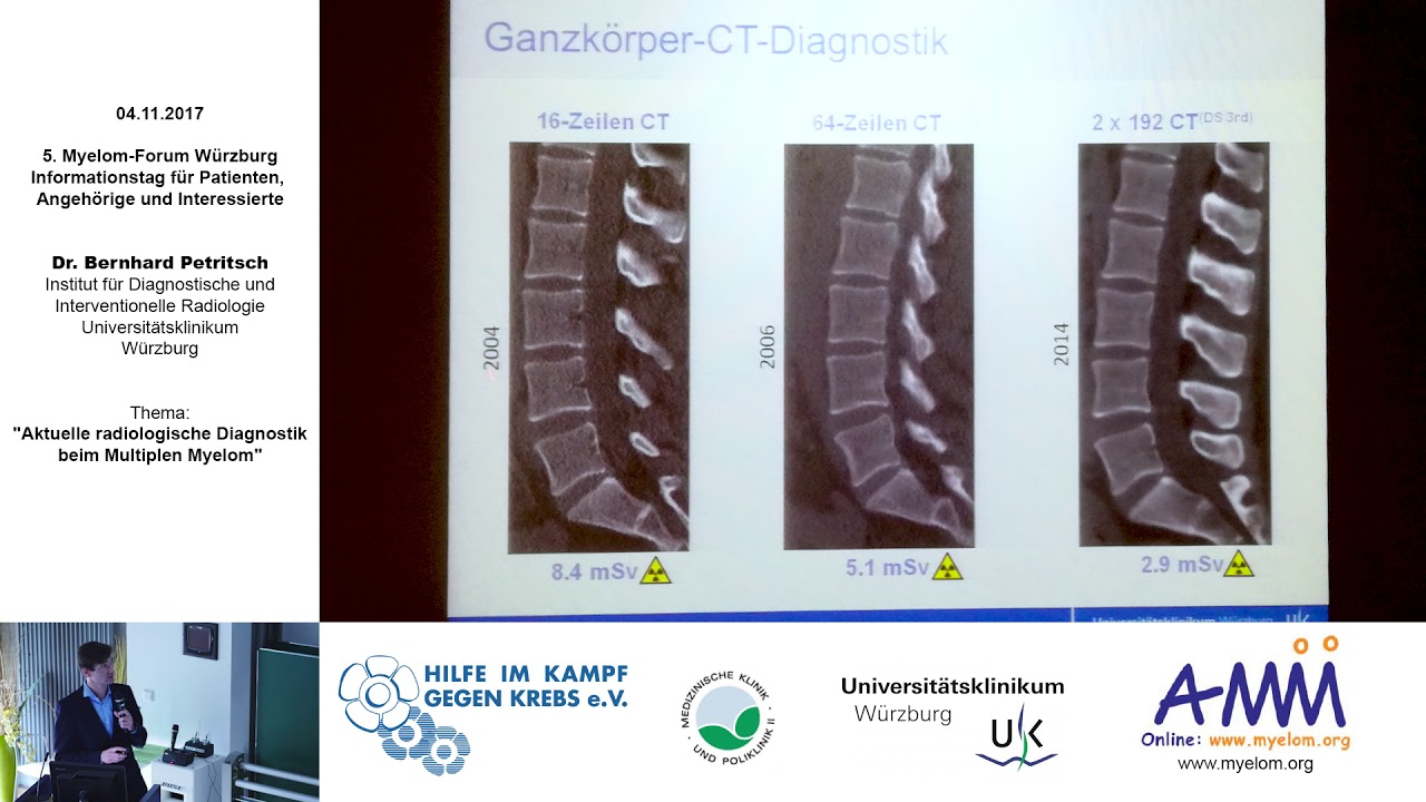 Aktuelle radiologische Diagnostik beim Multiplen Myelom 2017