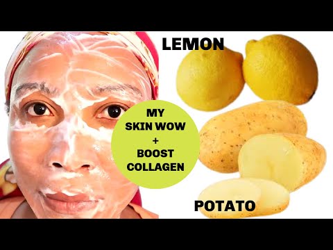 , title : 'I USE POTATO AND LEMON ON MY SKIN, LOOK WHAT IT DID TO MY SKIN, CLEAR SKIN, REDUCE WRINKLES,'