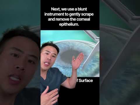 What is PRK laser eye surgery? #lasik #ophthalmology #optometry #prk #howitworks