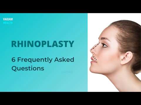 Rhinoplasty- 6 Frequently Asked Questions