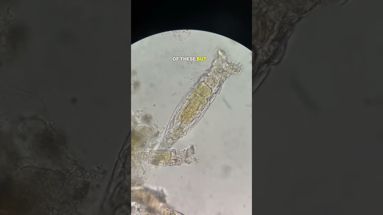 Microbe Eggs Under Microscope  #microscope #science #microscopy