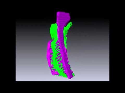 Scientific Reports : Three-dimensional architecture of podocytes revealed by block-face scanning... - YouTube