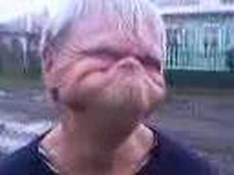 Magnificamente battuto la cameriera con lentiggini La maschera di decolorazione il lino bianco contro pigmentary nota su