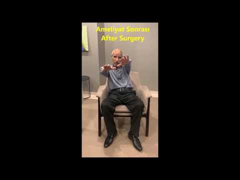 Beyin Pili (DBS) ile Parkinson Titremelerine Karşı Cerrahi Çözüm