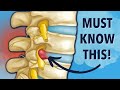 Why Herniated Disc Exercises Don T Work Must Know This