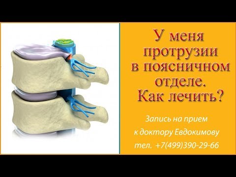 Какие боли от хондроза спины Если хрустит в тазобедренном суставе